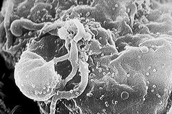 Virus is a microscopic particle that penetrates the cell and destroys it for reproductive purposes, the solution is not antibiotics but enhancing our immune system as I did Virus is a microscopic particle that penetrates the cell and destroys it for reproductive purposes, the solution is not antibiotics but enhancing our immune system as I did